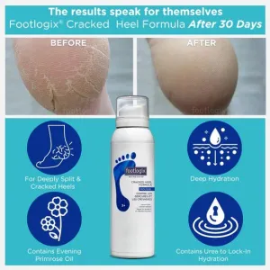 Footlogix Cracked Heel Formula Mousse