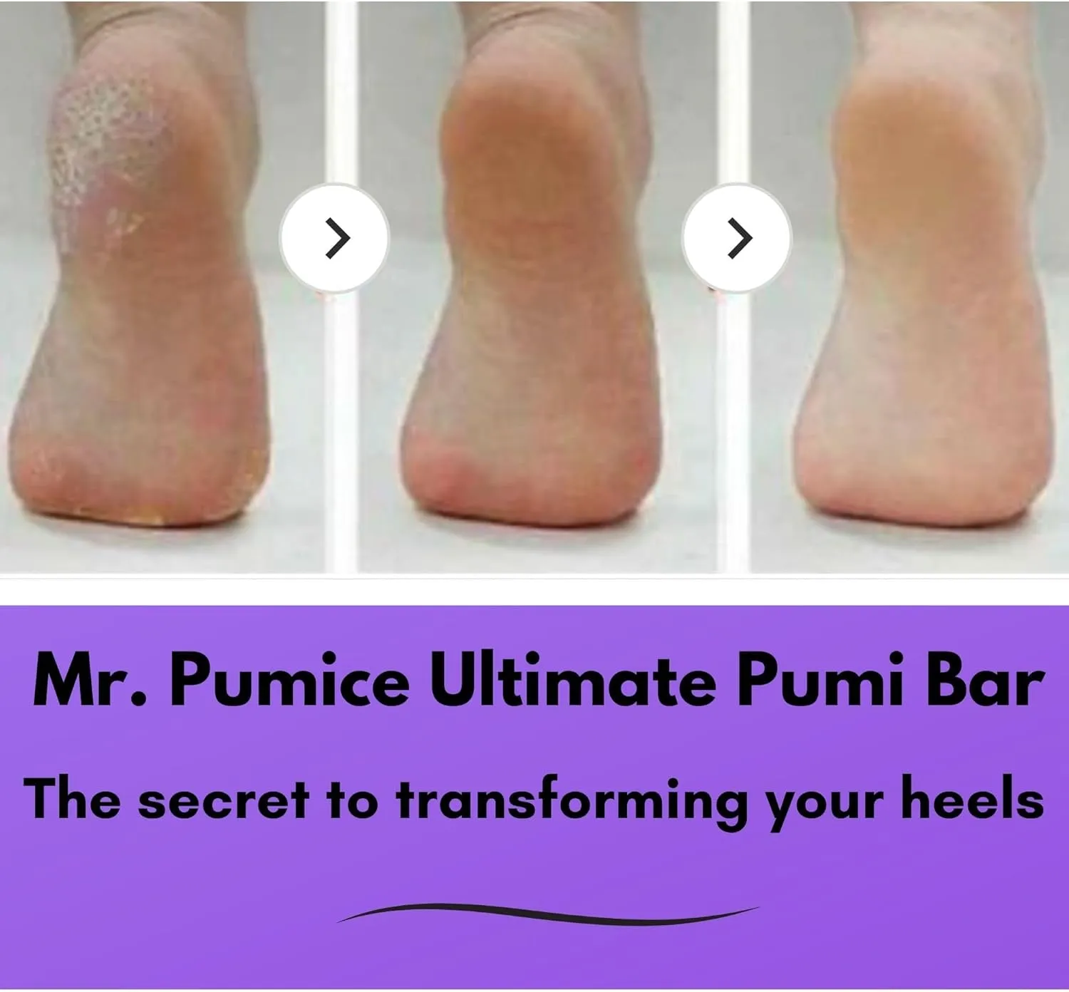 Ultimate PUMI Bar 2-In-1 Dual Grit (Medium   Coarse) Callus Remover, Pedicure Stone & Ped File Scrubber for Smooth Feet and Heels (4 Pack)