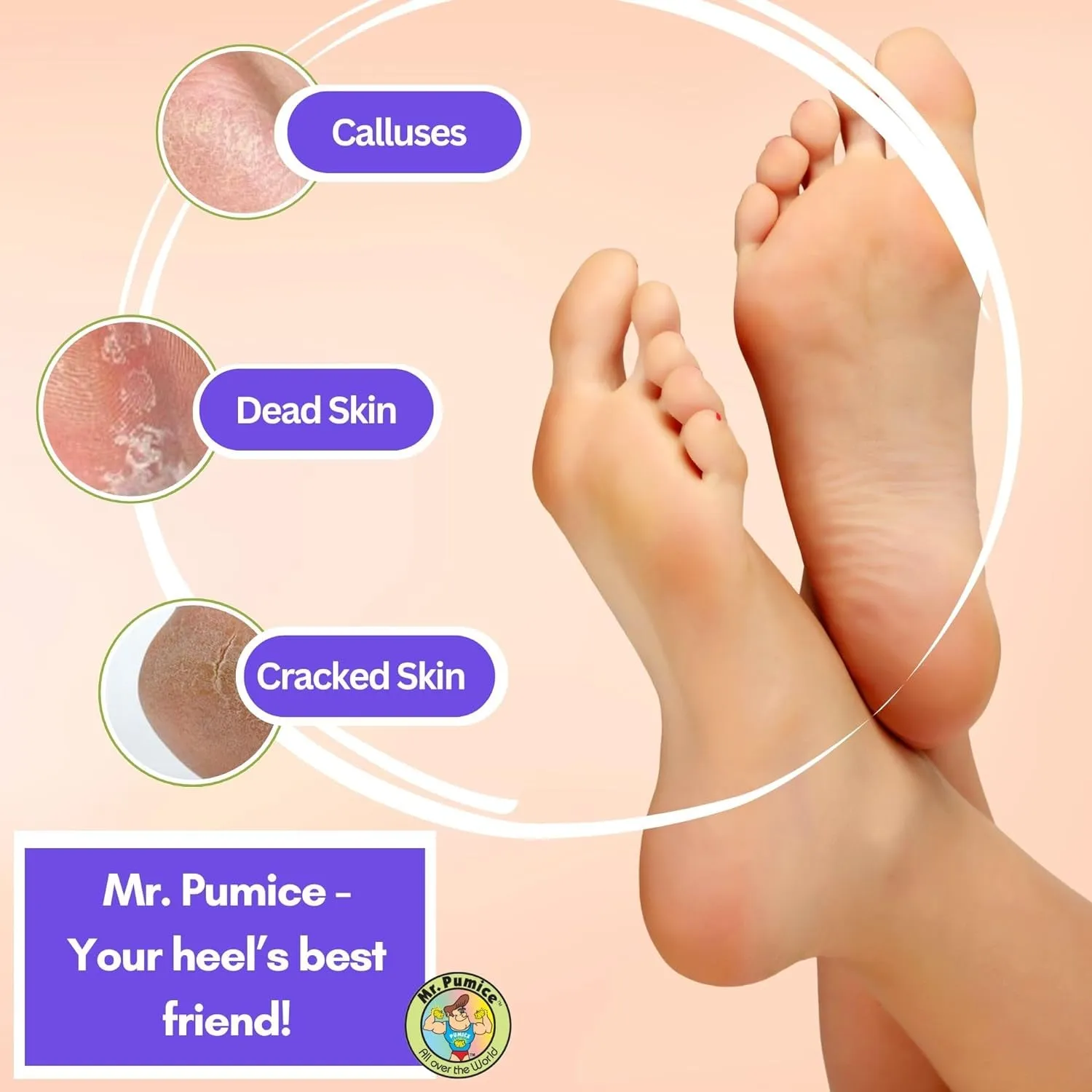 Ultimate PUMI Bar 2-In-1 Dual Grit (Medium   Coarse) Callus Remover, Pedicure Stone & Ped File Scrubber for Smooth Feet and Heels (4 Pack)